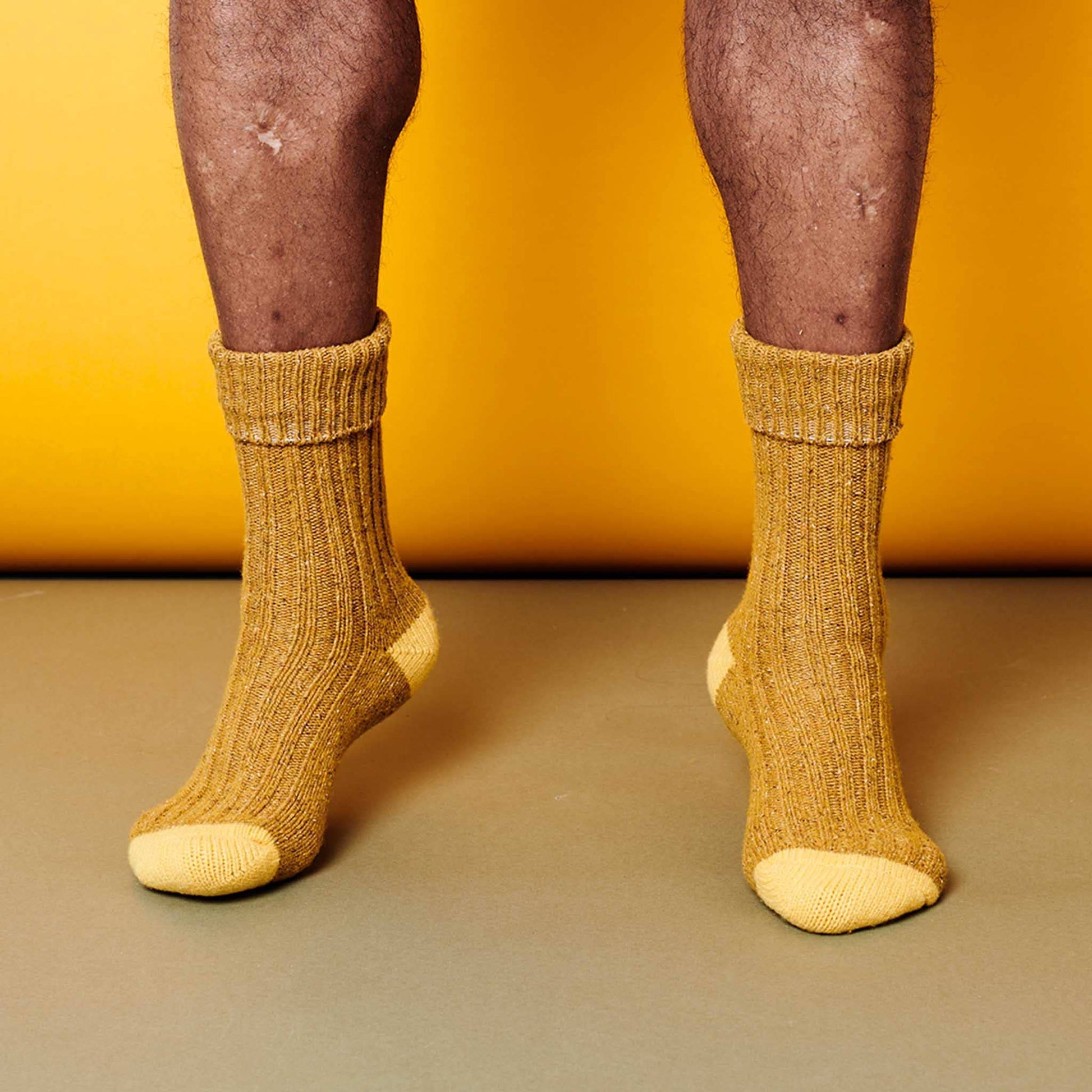 Yellow socks worn on feet against a yellow background